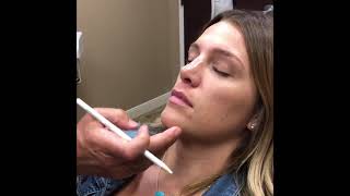 Non-Surgical Rhinoplasty | Philip S. Schoenfeld, M.D.