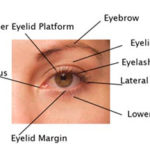 I’m interested in eyelid surgery
