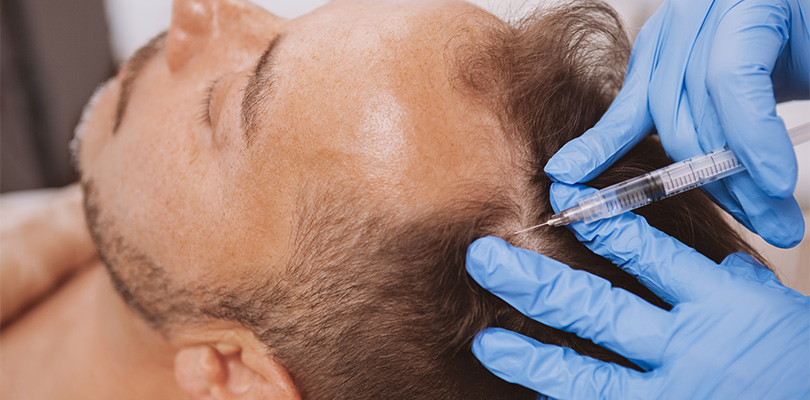 During the treatment, Dr. Schoenfeld draws your blood and spins it in a centrifuge to separate out growth factors and serum containing other blood products. 
Growth Factors for Hair Restoration | Washington DC