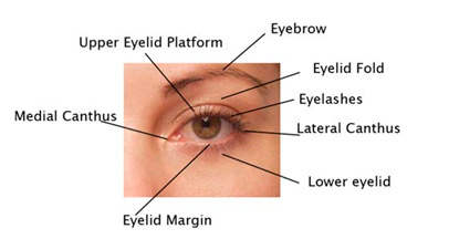 Blepharoplasty