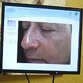 Thom's face fills a screen at Renu Med Spa